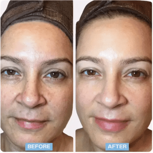 LED Face and Neck Therapy Massager